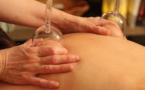 medi-cupping, diligent medical massage, find & fix™